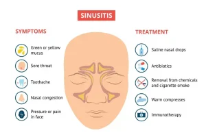 respiratory-sinusitis-symptoms